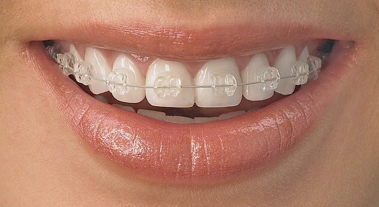 Ortodontia - Dra. Rosana Odontologia de Alta Performance
