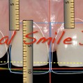 Smile Design