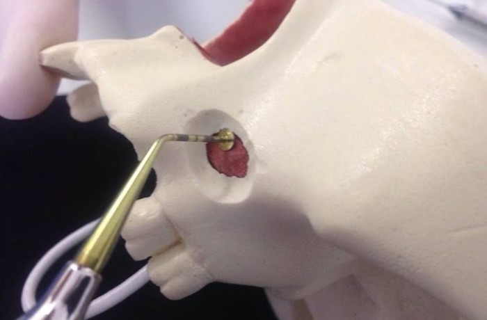 Cirurgia Bucomaxilofacial