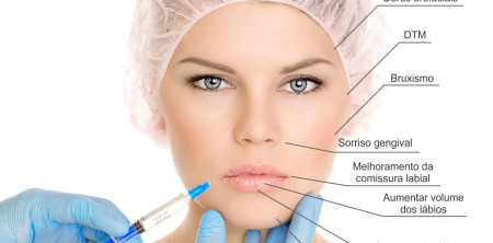 Botox na Odontologia