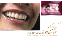 Tratamento dentário e autoestima.