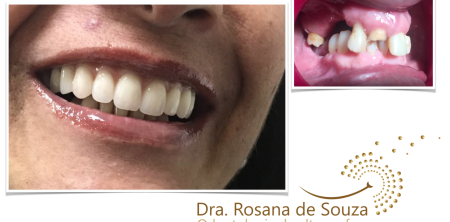 Tratamento dentário e autoestima.